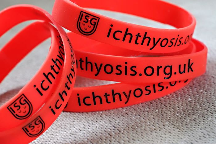 Red silicone ISG wristbands printed with ichthyosis.org.uk.